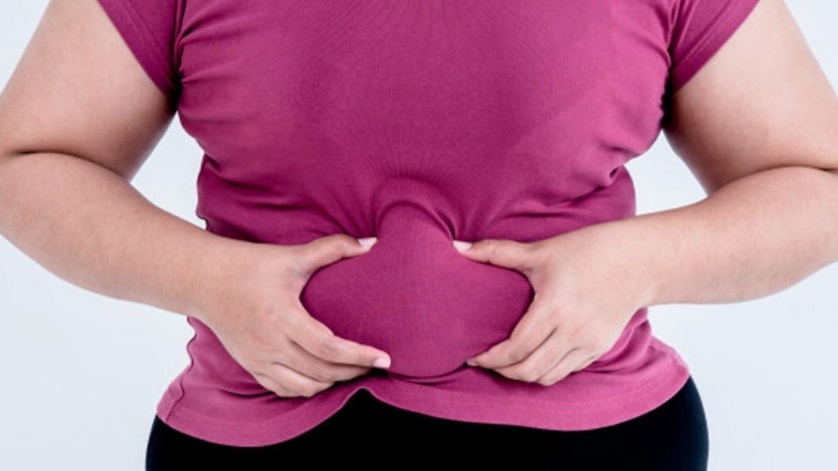 WHO की चेतावनी मोटापा नहीं है हंसी-मजाक