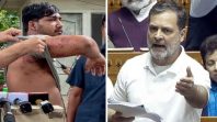 Pellet Gun पीड़ित छात्र की तस्वीर