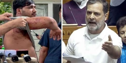 Pellet Gun पीड़ित छात्र की तस्वीर